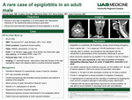A rare case of epiglottitis in an adult male by Advait Apte, Audrey Driver, Pierce Elliot, Alina Sehar, and John Fanning