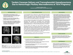 Tandem Cesarean Delivery and Transsphenoidal Hypophysectomy Due to Hemorrhagic Pituitary Macroadenoma at Term Pregnancy by A Assad and A Stisher