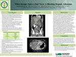 When Benign Takes a Bad Turn: A Bleeding Hepatic Adenoma by Ryland Beede, Lillian Royston, Soumyadeep Bag, and Roger D. Smalligan