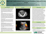 High-Grade Undifferentiated Uterine Sarcoma Presenting as Suspected Ovarian Torsion by Christian Just, Lillian Royston, and Leon Lewis