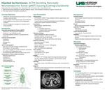 Hijacked by Hormones: ACTH-Secreting Pancreatic Neuroendocrine Tumor (pNET) Causing Cushing’s Syndrome by Hope Lackey, Ahmed Qaedi, Ross Hardin, Ali Hachem, and Farrah Ibrahim