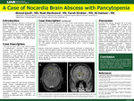 A Case of Nocardia Brain Abscess with Pancytopenia by Ahmed Qaedi, Noah Blackwood, Farrah Ibrahim, and Ali Hachem