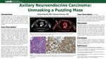 Axillary Neuroendocrine Carcinoma: Unmasking a Puzzling Mass by Ahmed Qaedi and Chelsea Palmer